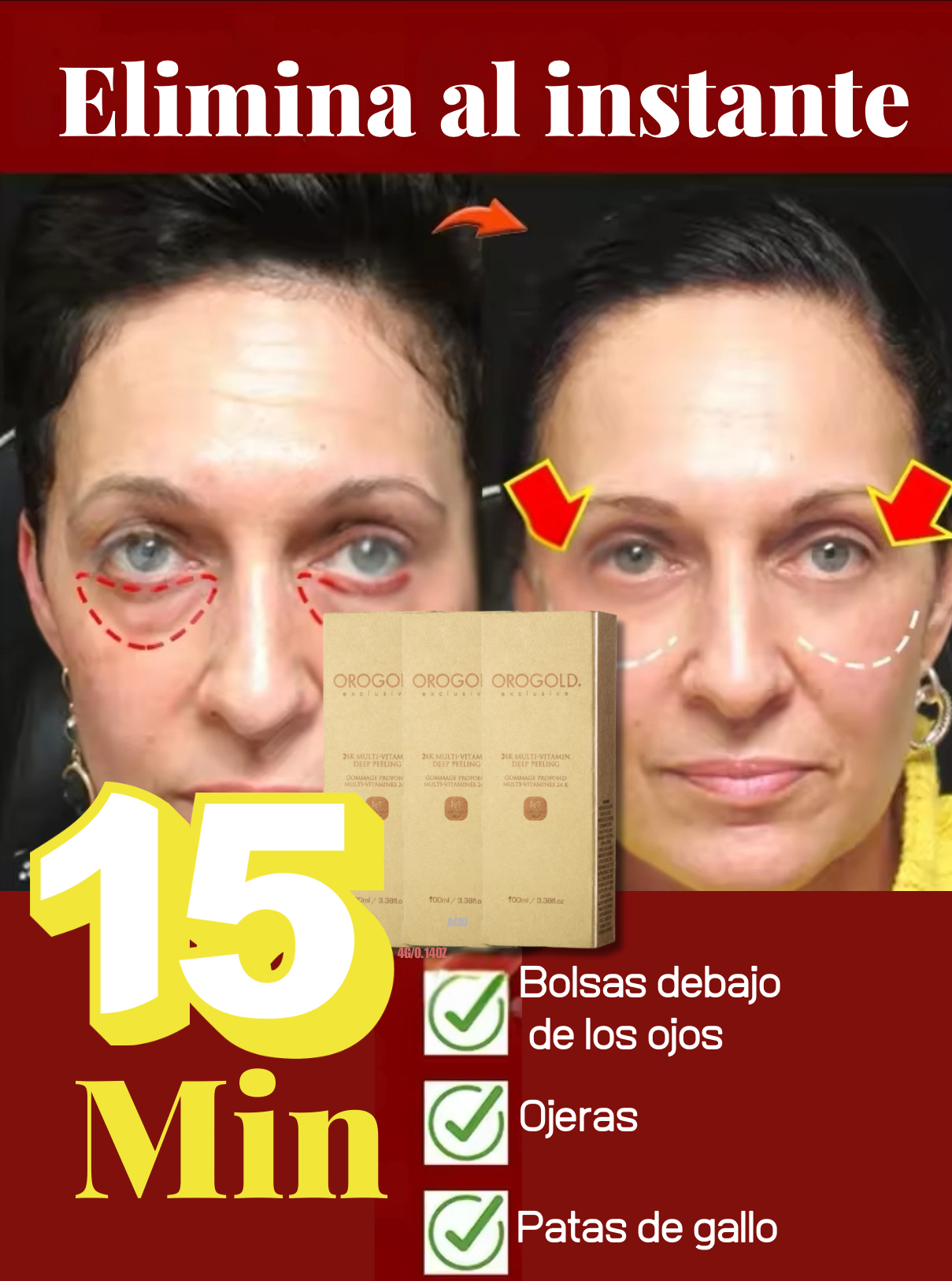 2 CONTORNO DE OJOS 👀 CERO ARRUGAS EN MINUTOS - LumiEyes 🔥🤩