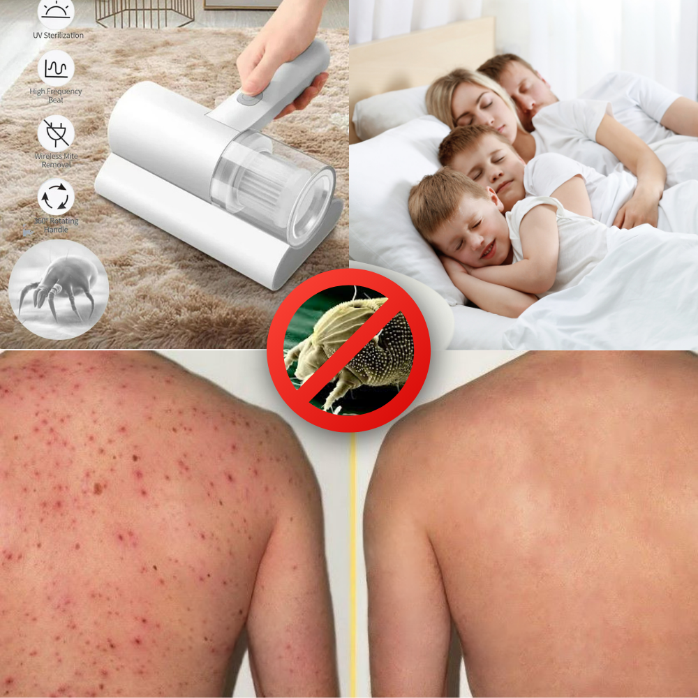 Aspiradora Antiácaros PureSleep™ – Elimina Ácaros, Polvo y Bacterias con Luz UV + Succión Potente 💨🛏️