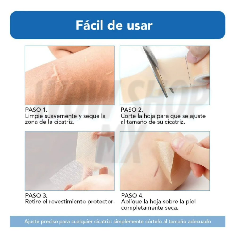 3mts Tira de Silicona para Cicatrices ScarSilk™ – Reduce Cicatrices, Queloides y Marcas Visibles + 🎁 Guía “10 Secretos Dermatológicos para Atenuar Cicatrices y Recuperar la Confianza en tu Piel” + Envío Gratis