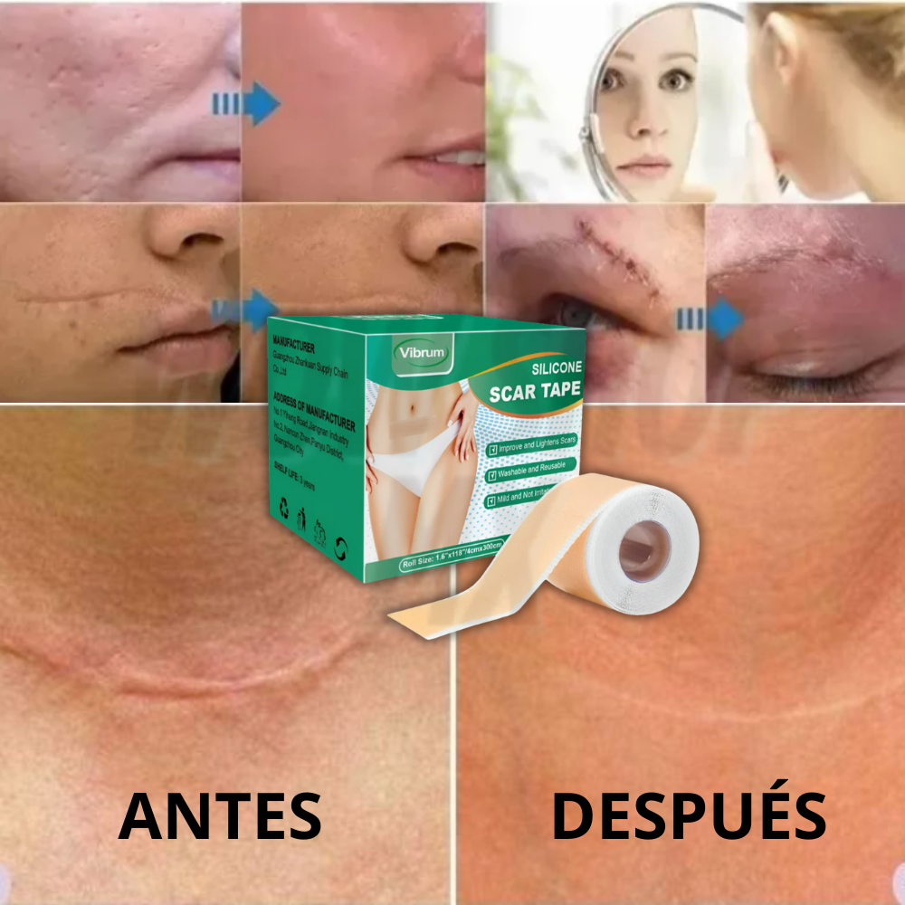 3mts Tira de Silicona para Cicatrices ScarSilk™ – Reduce Cicatrices, Queloides y Marcas Visibles + 🎁 Guía “10 Secretos Dermatológicos para Atenuar Cicatrices y Recuperar la Confianza en tu Piel” + Envío Gratis