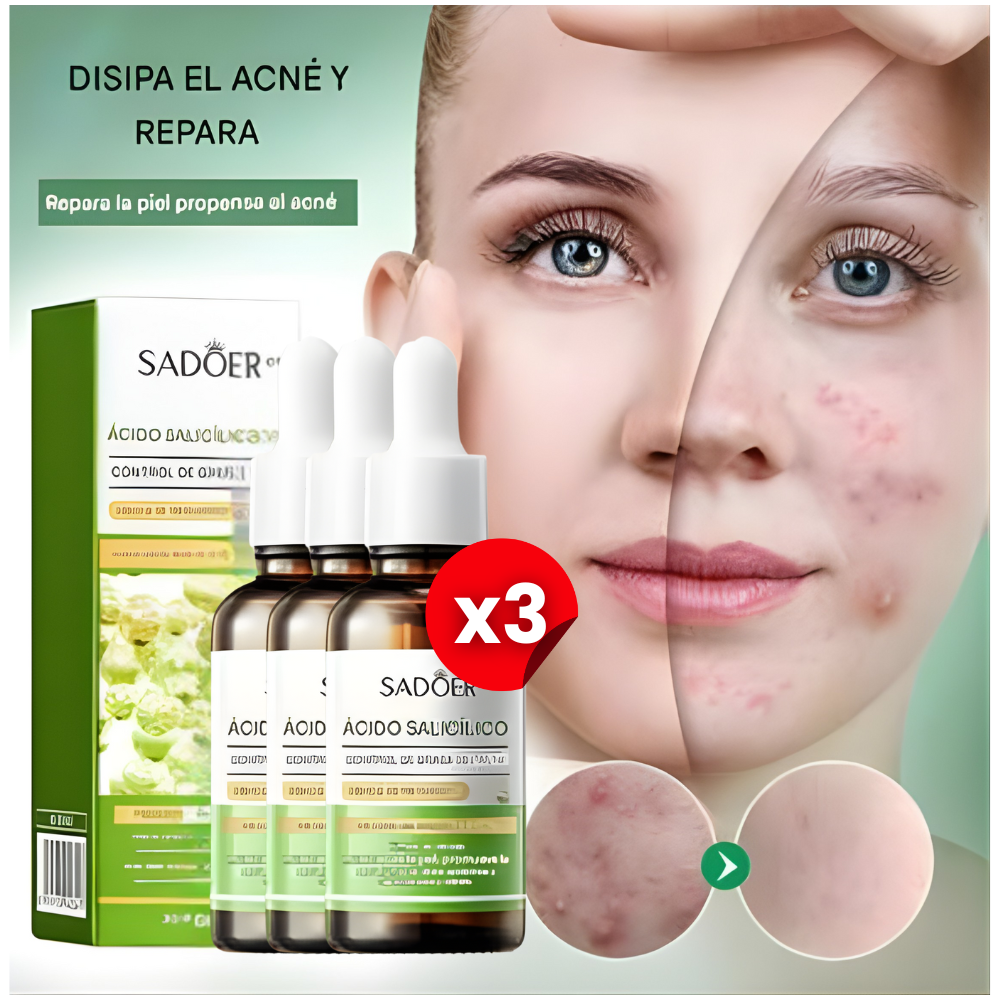 3x1 Suero ClearSkin Pro™ – Sérum de Ácido Salicílico para Acné, Brotes y Poros Obstruidos +🎁 Guía de Seguridad y Autoconfianza GRATIS + Envío Grati