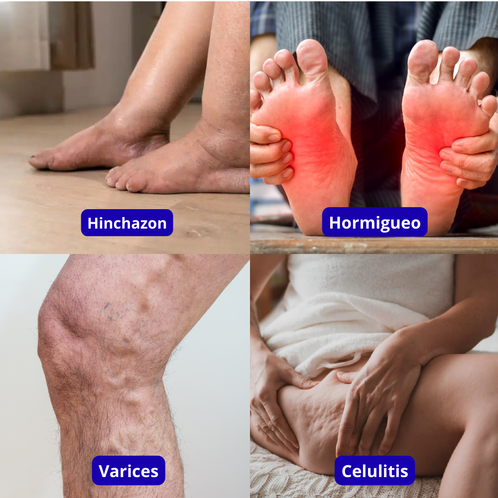 Pack x6 Pares – Calcetas de Compresión para Aliviar Várices y Mejorar la Circulación | Piernas Más Ligeras, Menos Hinchazón y Mayor Descanso Diario + 🎁 Manual de Ejercicios para Activar la Circulación + Envío Gratis + 🇫🇷 TECNOLOGIA FRANCESA 🇫🇷