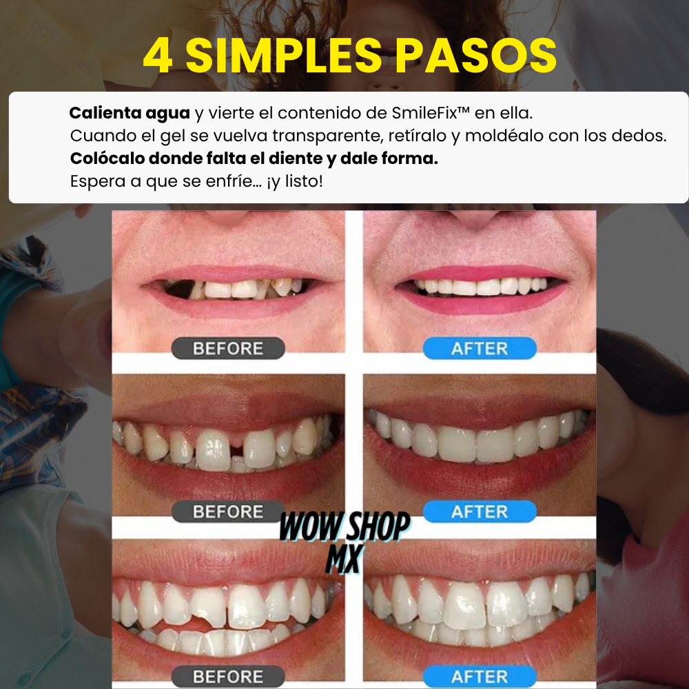🦷 2X1 - Gel Moldeador Dental Instantáneo + 🎁Manual "Como reparar tu diente perfecto en minutos" + ENVÍO GRATIS