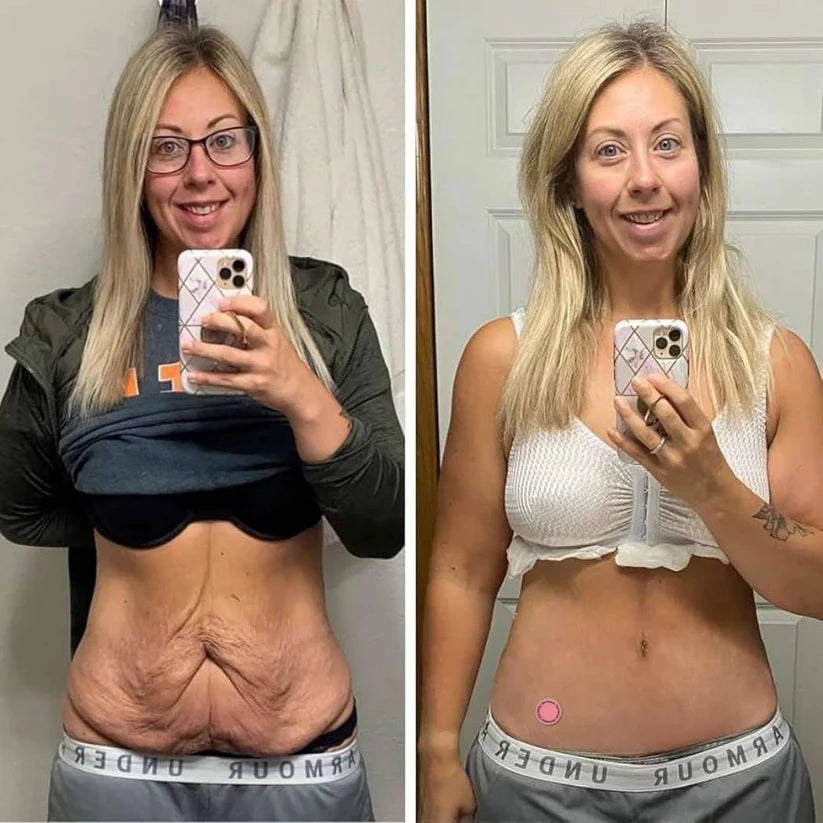 100 Parches para Bajar de Peso LipoPatch®️ + 🎁Guia Infalible para perder tallas en 14 dias + Envio Gratis