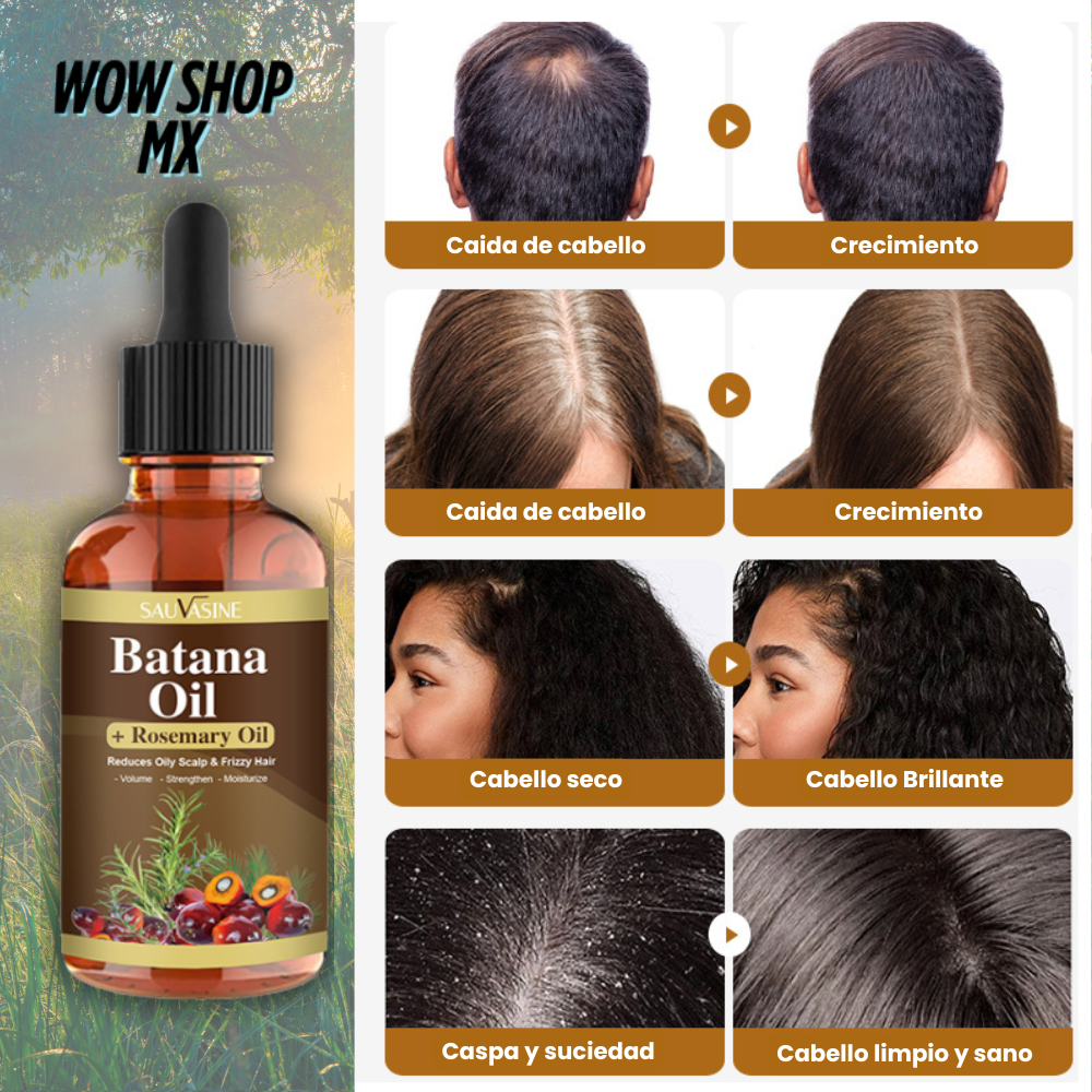 3X1 Aceite de Batana con Minoxidil: Regenera tu Cabello + 🎁Manual de Regeneración Capilar y Secretos para Lucir Más Atractivo + Envío Gratis
