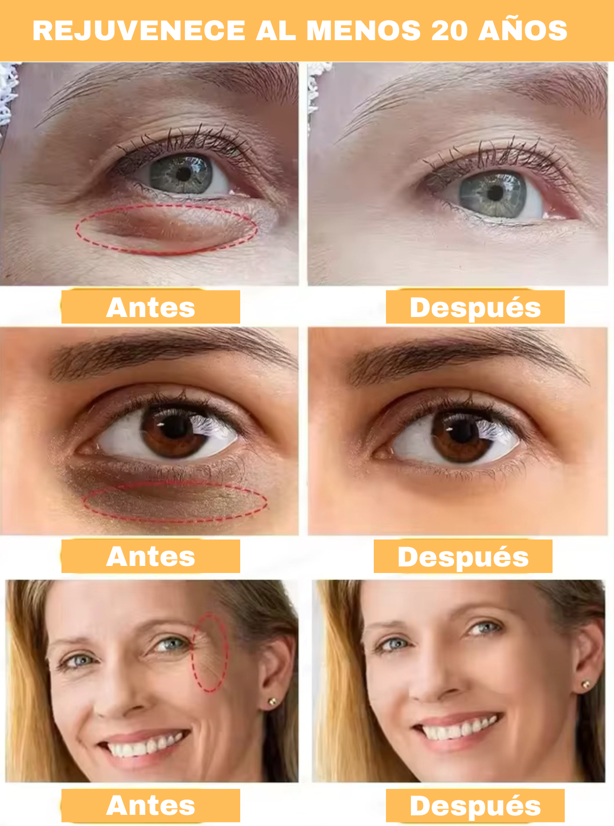 2 CONTORNO DE OJOS 👀 CERO ARRUGAS EN MINUTOS - LumiEyes 🔥🤩