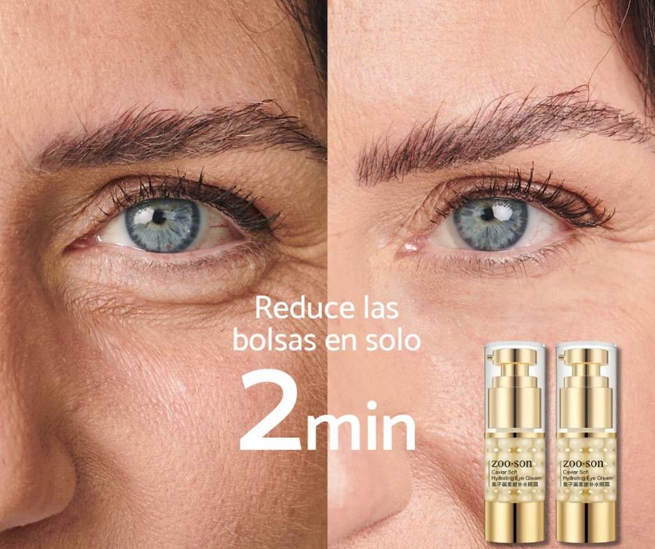 2 CONTORNO DE OJOS 👀 CERO ARRUGAS EN MINUTOS - LumiEyes 🔥🤩