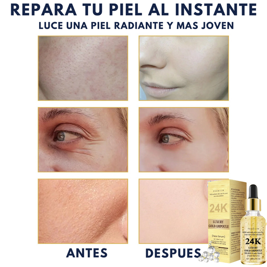3 Sueros de Oro - Glow Elixir para lucir hasta 10 años más joven 👩‍🦳👱‍♀️