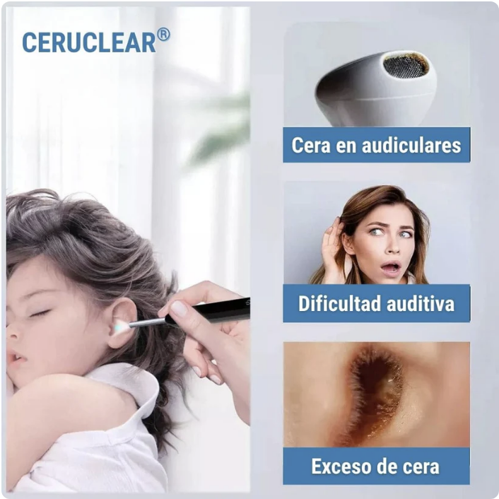 🤩 COMBO 2̳X̳1̳ Limpiador de oidos con Camara HD 📸👂🏼 - Proteccion auditiva y Cuidado Profesional en Casa 🏡