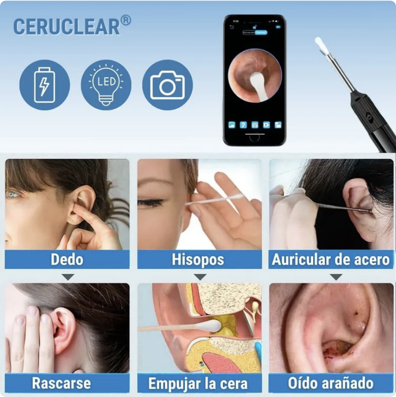 🤩 COMBO 2̳X̳1̳ Limpiador de oidos con Camara HD 📸👂🏼 - Proteccion auditiva y Cuidado Profesional en Casa 🏡