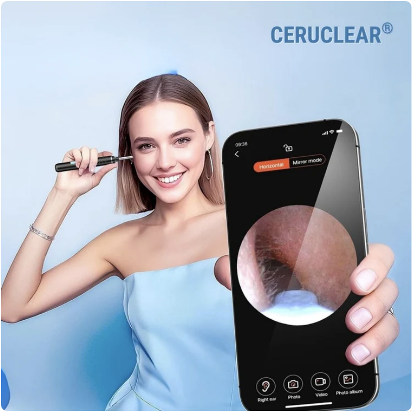 🤩 COMBO 2̳X̳1̳ Limpiador de oidos con Camara HD 📸👂🏼 - Proteccion auditiva y Cuidado Profesional en Casa 🏡