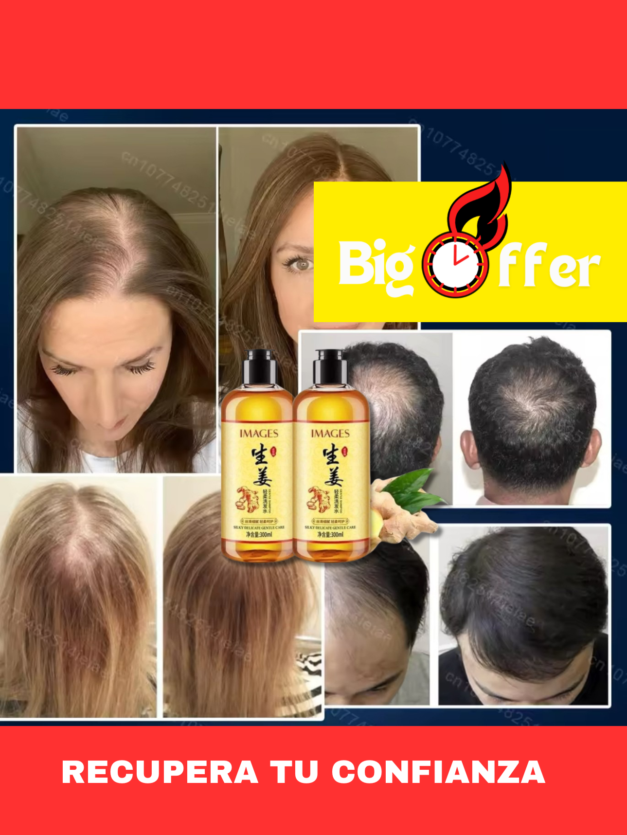 2X1 Shampoo CreceMax 🔥🤩 Crecimiento de cabello en solo 7 dias 👨🏻‍🦱