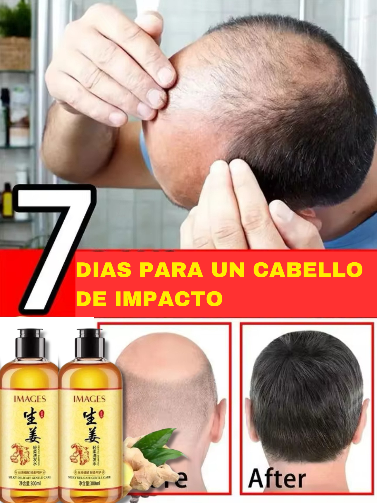 2X1 Shampoo CreceMax 🔥🤩 Crecimiento de cabello en solo 7 dias 👨🏻‍🦱