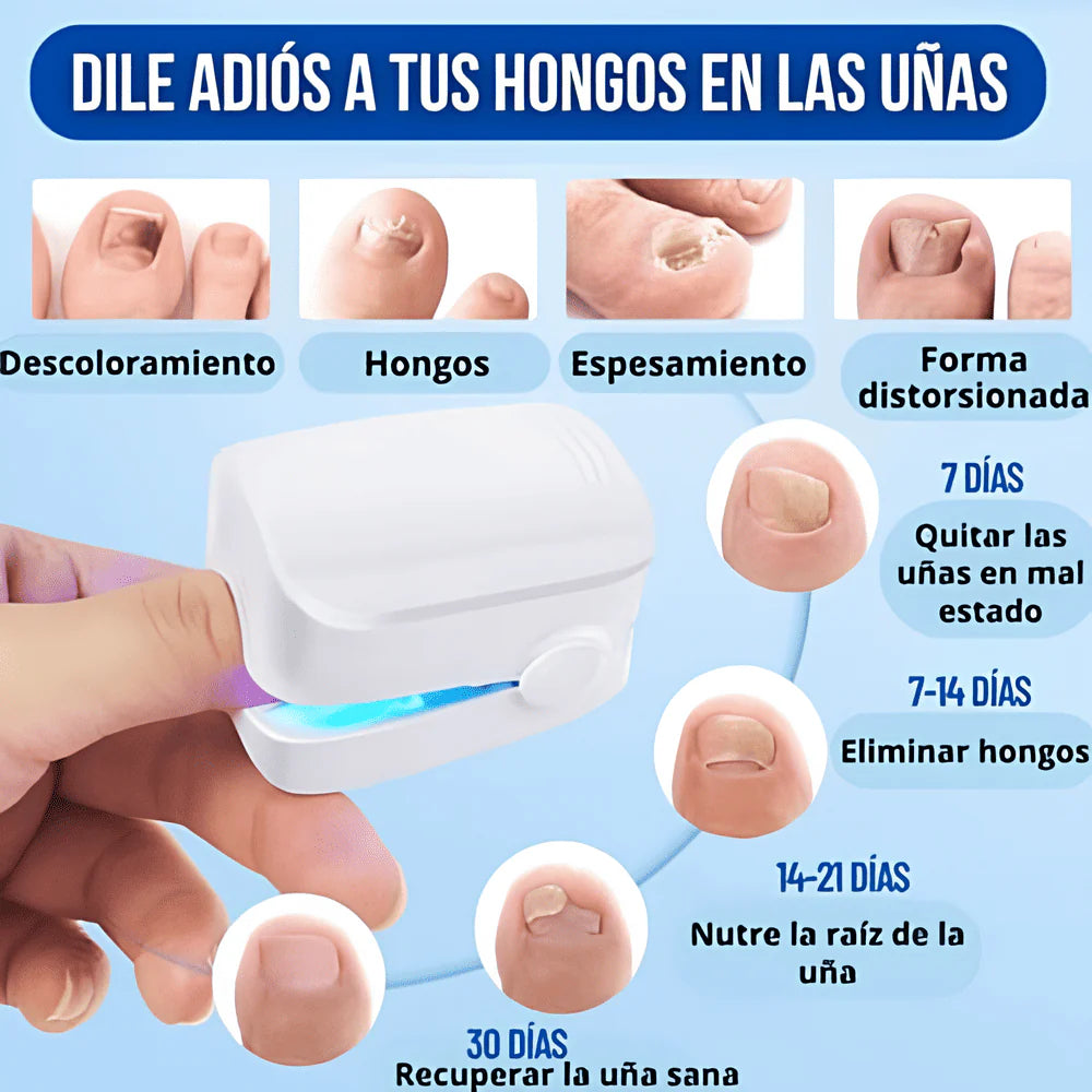 👣 LÁSER PORTÁTIL ELIMINA ONICOMICOSIS EN 7 DIAS✨ – ¡LLÉVATE 2X1 HOY!