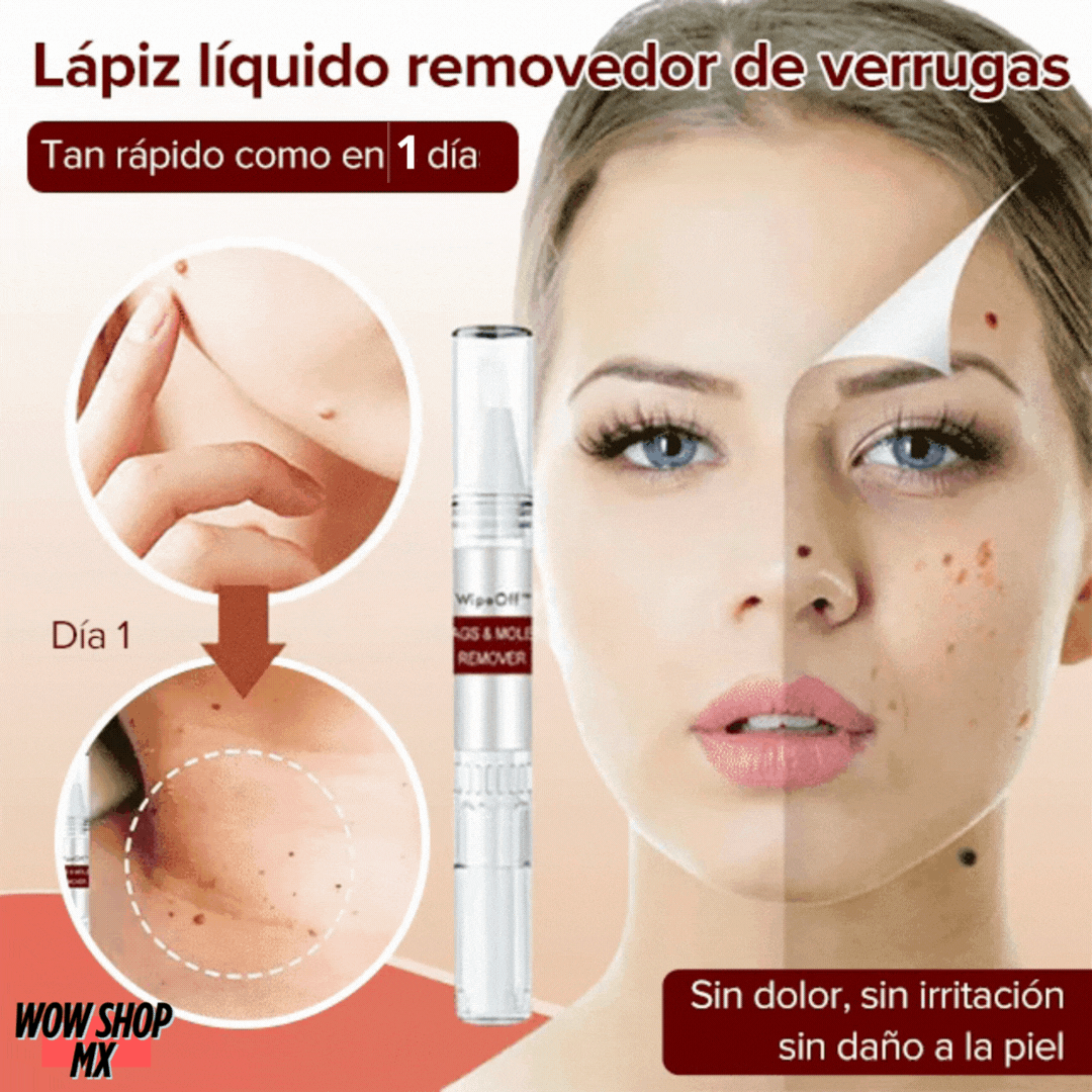 VerriGo Pro®️ Elimina Verrugas, Manchas y Tatuajes Desde Casa