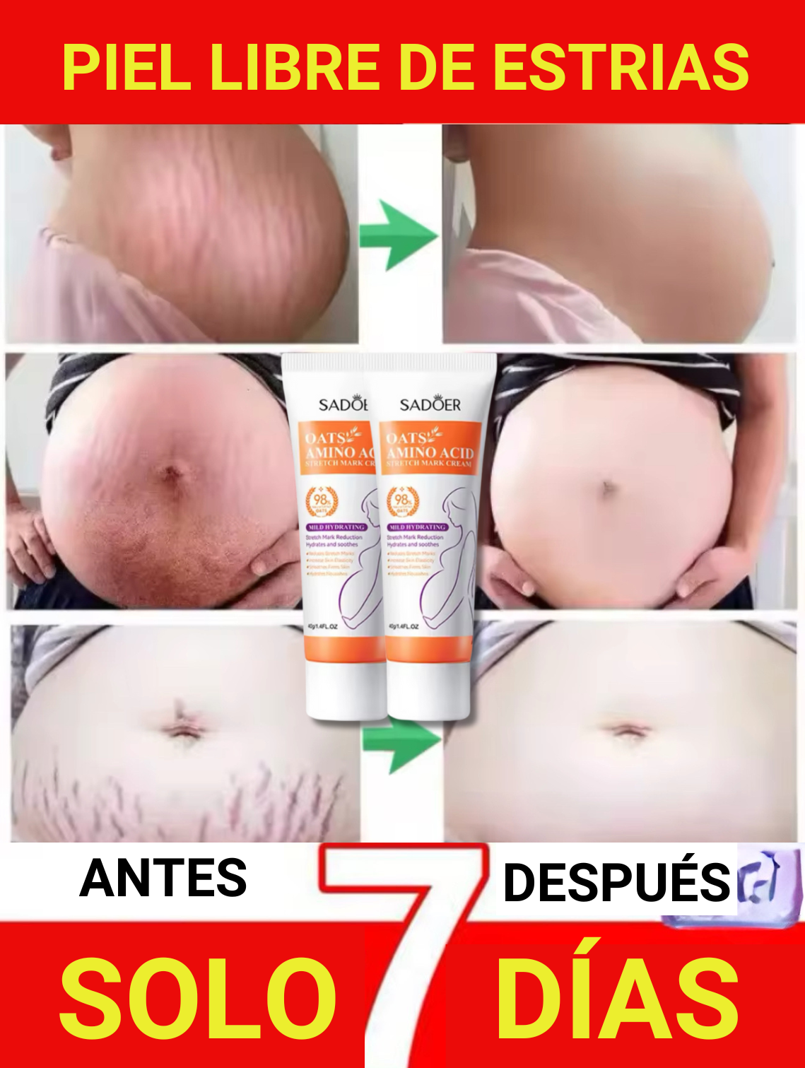 2 Cremas elimina estrías al instante - Con StriaLess olvídate de las estrías en solo 7 dias 🔥😍