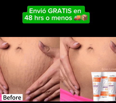 2 Cremas elimina estrías al instante - Con StriaLess olvídate de las estrías en solo 7 dias 🔥😍
